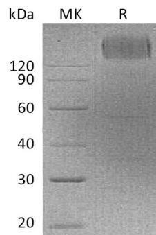 Human CEACAM5/CEA Recombinant Protein (RPES0336)