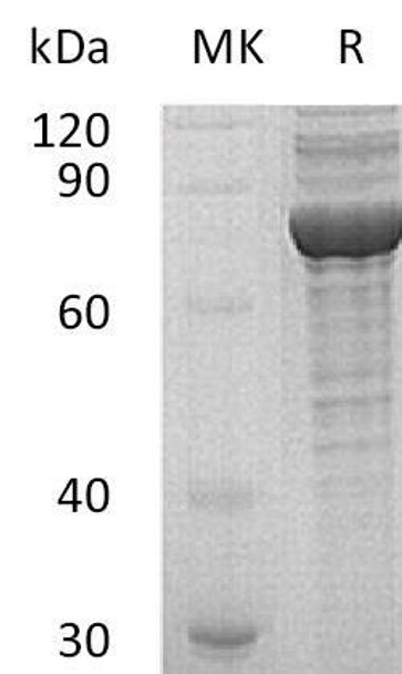 Human PRKG1 Recombinant Protein (RPES0433)