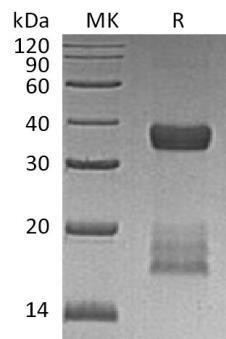 Human CGREF1/CGR11 Recombinant Protein (RPES0452)