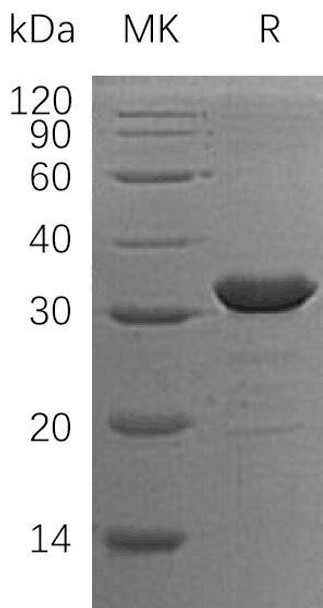 Human CLIC2 Recombinant Protein (RPES0509)