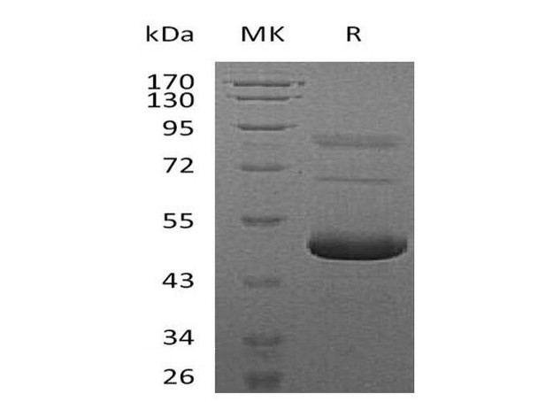 Mouse Ephrin-A5/EFNA5 Recombinant Protein (RPES0514)