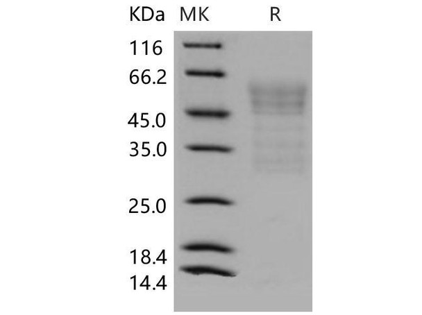 Mouse Syndecan/SDC1 Recombinant Protein (His Tag) (RPES0563)