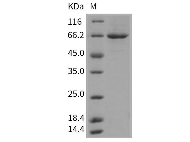 Mouse PLK1/PLK Recombinant Protein (His Tag) (Active) (RPES0608)
