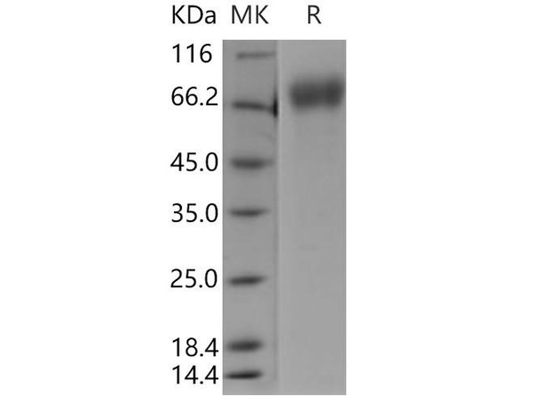 Human IFNAR1/IFNAR Recombinant Protein (His Tag) (RPES0673)