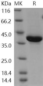 Human Neuregulin/NRG1-Beta 1 Recombinant Protein (RPES0762)