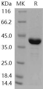 Human AKR1A1 Recombinant Protein (His Tag) (RPES0798)