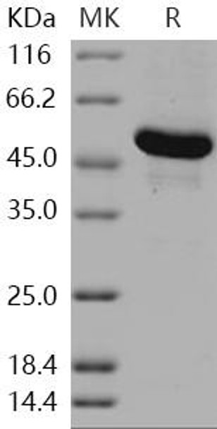 Human GBA3/CBGL1 Recombinant Protein (RPES0853)