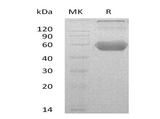 Mouse GITR/TNFRSF18 Recombinant Protein (RPES0865)