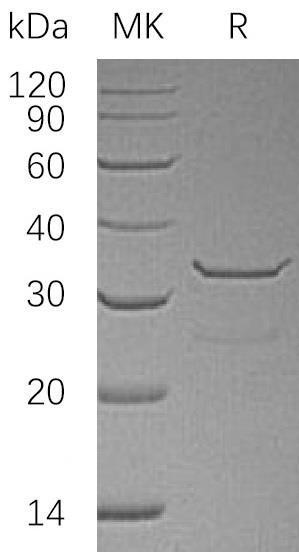 Human SULT1B1 Recombinant Protein (His Tag) (Active) (RPES0872)
