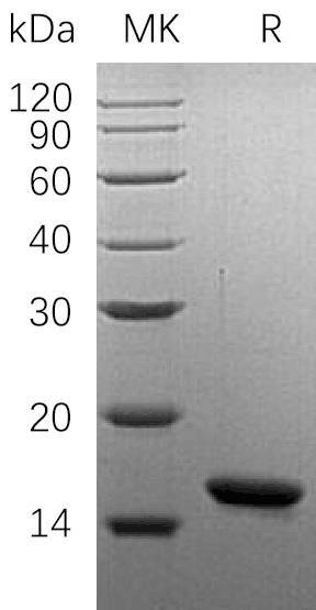 Human Oncomodulin/OCM Recombinant Protein (RPES0881)