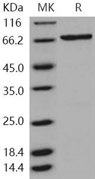Human SGK3/SGKL Recombinant Protein (His & GST Tag) (RPES0895)