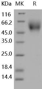 Human DR6/TNFRSF21 Recombinant Protein (RPES0928)