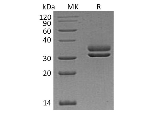 Human CFHR2 Recombinant Protein (RPES0951)