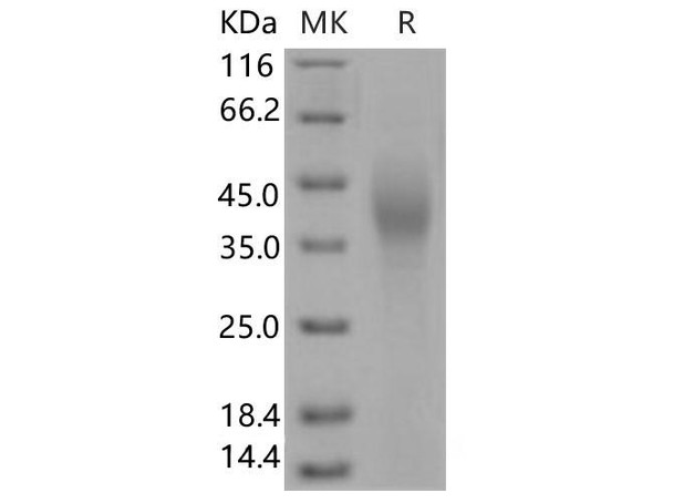 Human SLAMF7/CD319 Recombinant Protein (His Tag) (Active) (RPES0968)