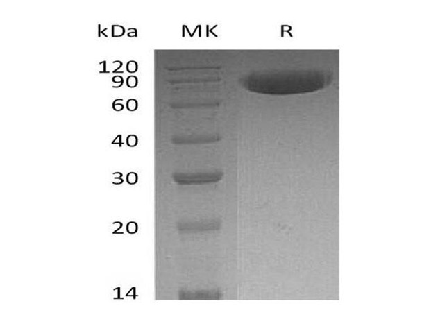 Human OX-2/MOX1/CD200 Recombinant Protein (RPES0990)