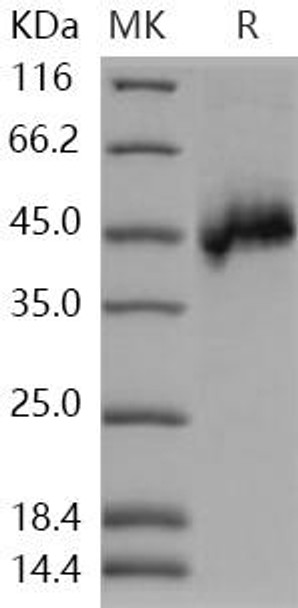 Human NETO1/BTCL1 Recombinant Protein (His Tag) (RPES1032)