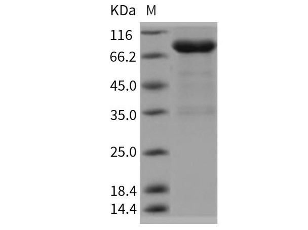 Rat UNC5B/UNC5H2 Recombinant Protein (Fc Tag) (RPES1090)