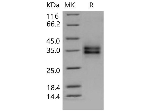 Mouse FOLR1 Recombinant Protein (aa 1-231, His Tag) (RPES1129)