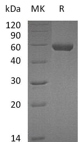 Mouse Carboxypeptidase M/CPM Recombinant Protein (His Tag) (Active) (RPES1136)