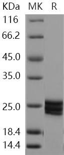 Human ESM1/Endocan Recombinant Protein (His Tag) (Active) (RPES1168)