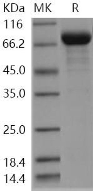 Human ENPP5 Recombinant Protein (His Tag) (RPES1237)