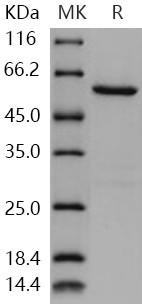Human NEK7 Recombinant Protein (His & GST Tag) (RPES1250)