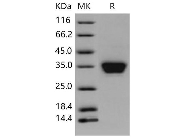 Mouse ASAM Recombinant Protein (His Tag) (Active) (RPES1273)