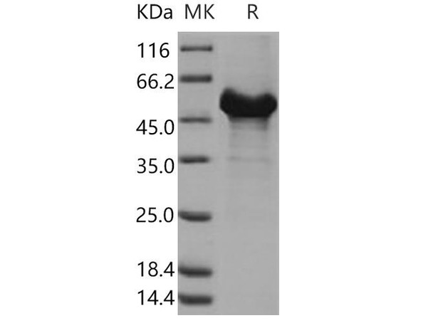 Human RTN4/NOGO-A Recombinant Protein (GST Tag) (Active) (RPES1554)
