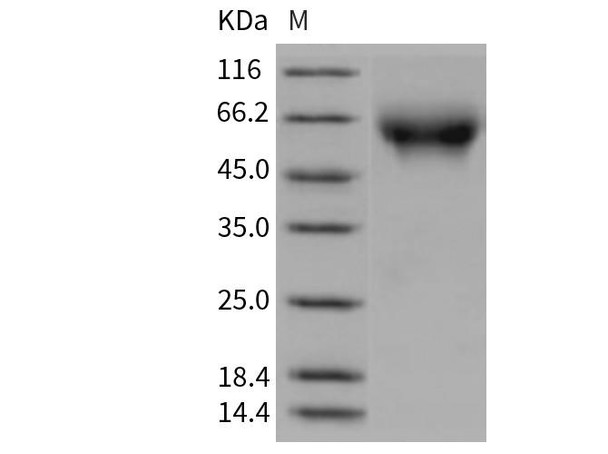 Rat CD155/PVR/NECL5 Recombinant Protein (His Tag) (Active) (RPES1558)
