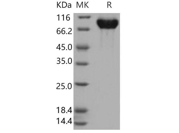 Human PIGR Recombinant Protein (365 Ser/Gly, His Tag) (Active) (RPES1596)