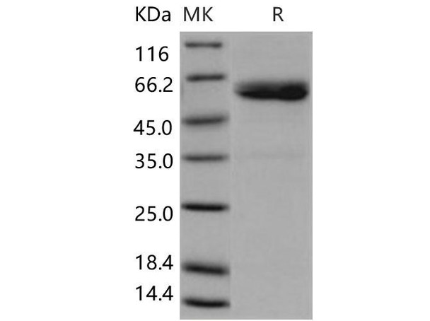 Human ULBP1/N2DL1 Recombinant Protein (His & Fc Tag) (Active) (RPES1615)