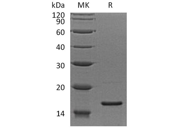 Human RPS19 Recombinant Protein (RPES1639)