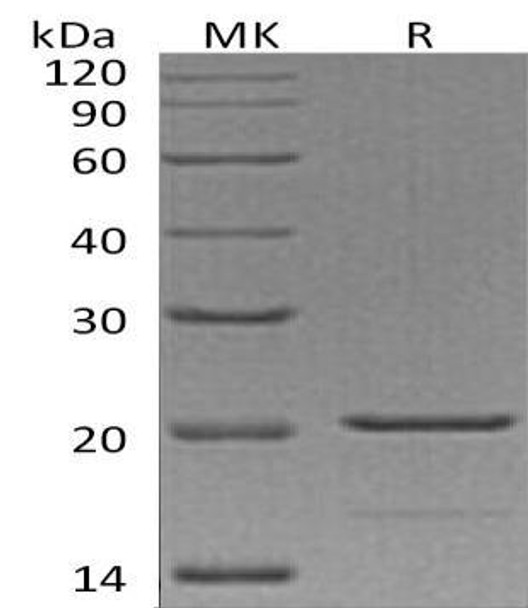 Human TNF-alpha/TNFA Recombinant Protein (RPES1664)