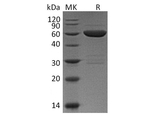 Mouse Galectin 9/LGALS9 Recombinant Protein (RPES1711)