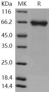Human FLRT1 Recombinant Protein (His Tag) (Active) (RPES1714)