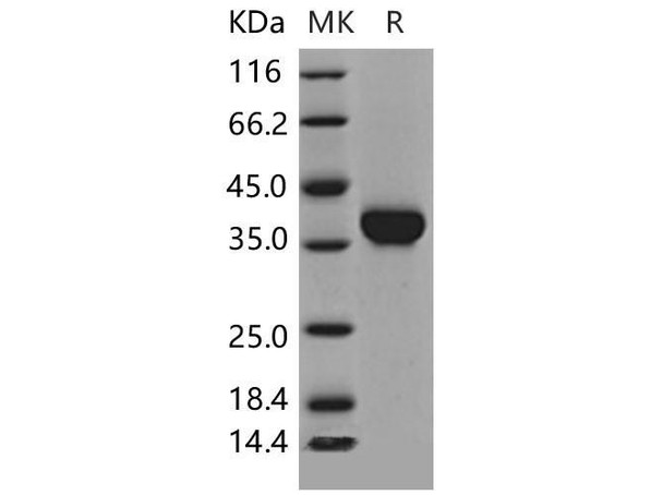 Mouse Carbonic Anhydrase X/CA10 Recombinant Protein (His Tag) (Active) (RPES1744)