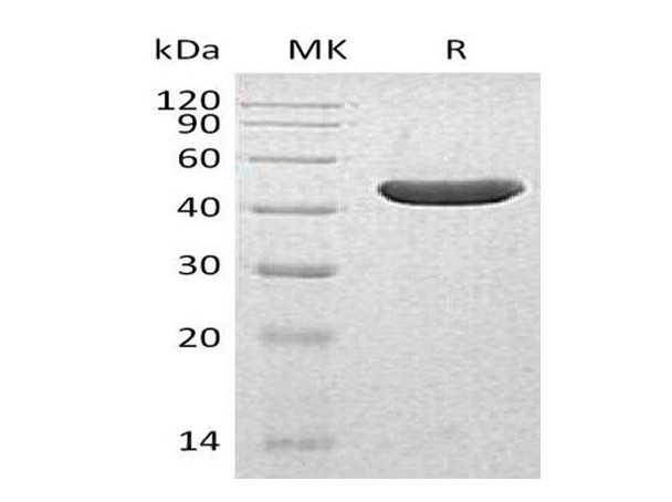Human INPP5A Recombinant Protein (RPES1763)