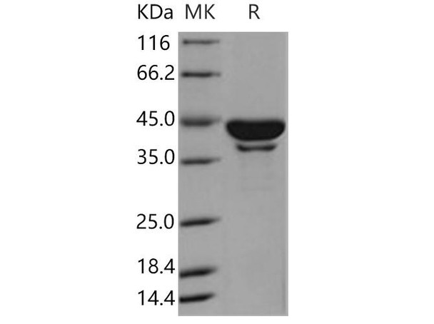 Human SerpinB6/PI-6 Recombinant Protein (His Tag) (RPES1833)