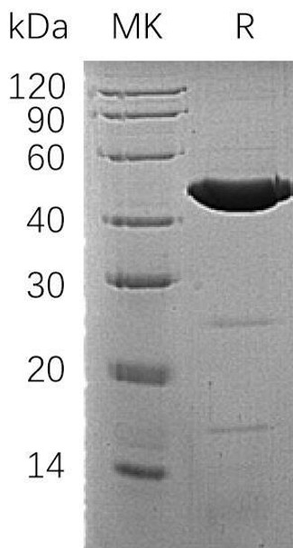 Human ACADM/MCAD Recombinant Protein (RPES1858)