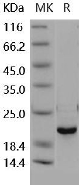 Human DUSP3/VHR Recombinant Protein (Active) (RPES1873)