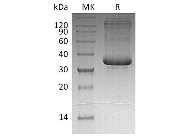 Human SP0/ACRV1 Recombinant Protein (RPES1877)