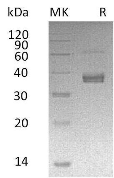 Human ADAMDEC1 Recombinant Protein (RPES2080)