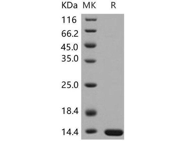 Human LAMTOR2/ROBLD3/MAPBPIP Recombinant Protein (His Tag) (RPES2241)