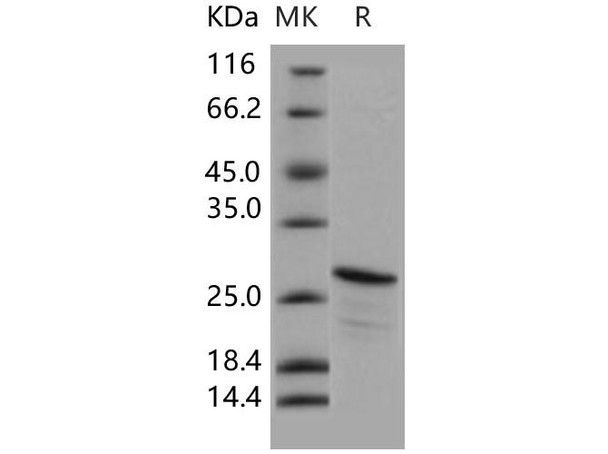Human CIB2/KIP-2 Recombinant Protein (His Tag) (RPES2301)