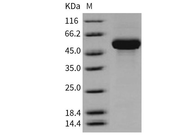 Human CD131/CSF2RB Recombinant Protein (His Tag) (Active) (RPES2389)