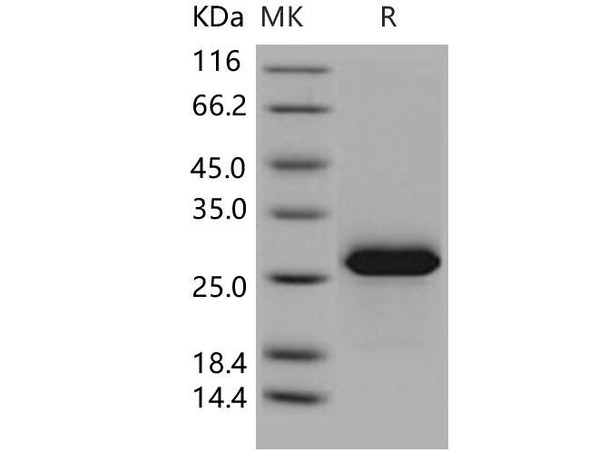 Human MESDC2/MESD Recombinant Protein (His Tag) (RPES2439)