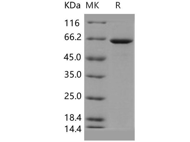Human GBP1 Recombinant Protein (His Tag) (RPES2474)