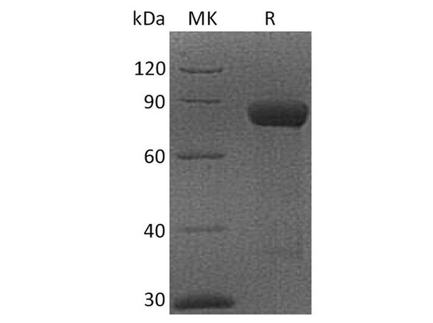 Cynomolgus CRTAM/CD355 Recombinant Protein (RPES2531)