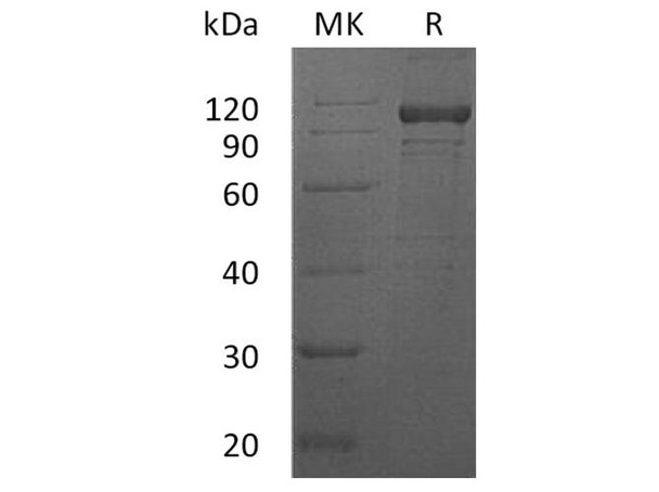 Human IL12RB1 Recombinant Protein (RPES2610)