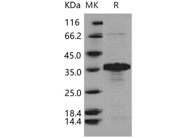 Human BNIP3L Recombinant Protein (RPES2614)
